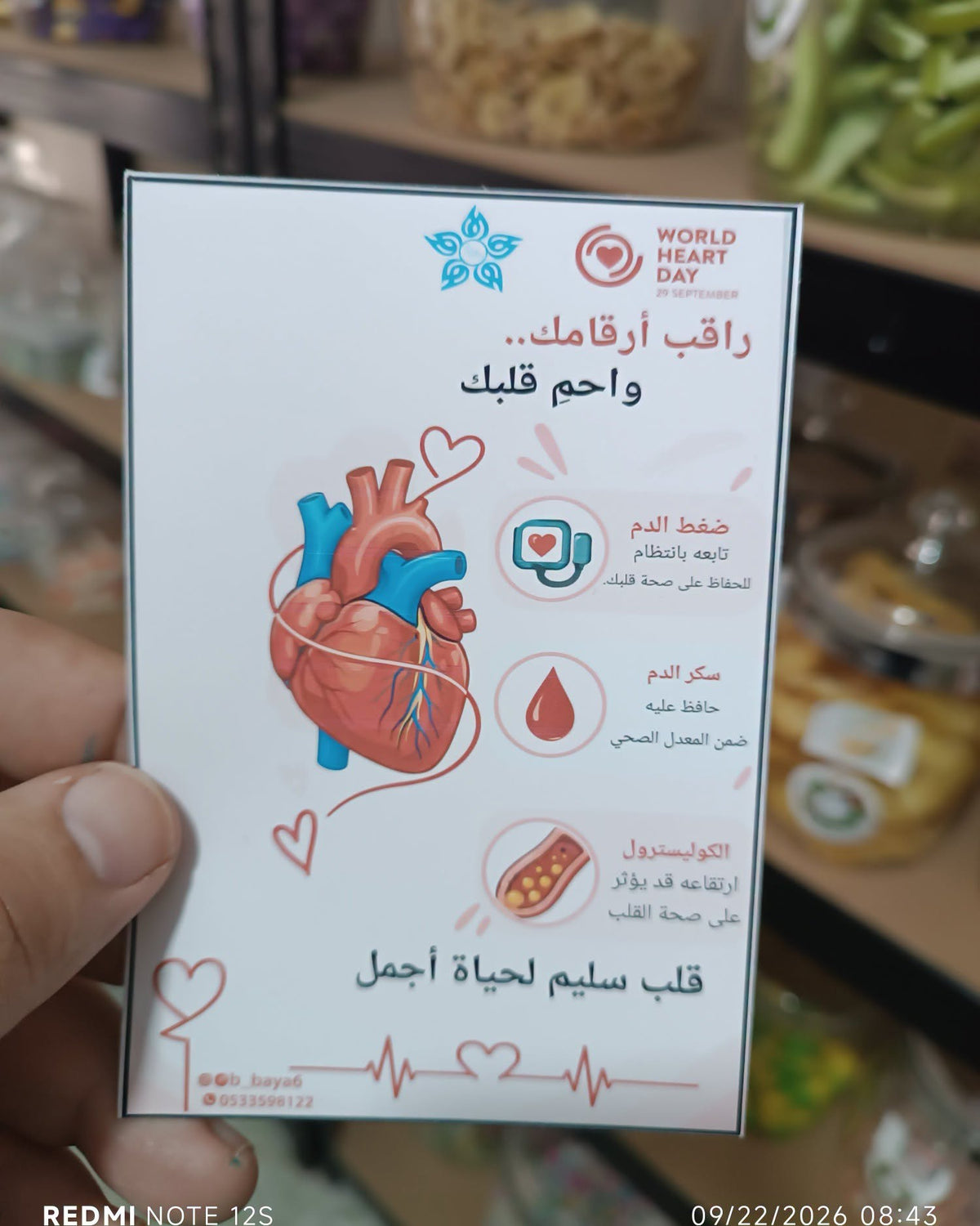 توزيعة (