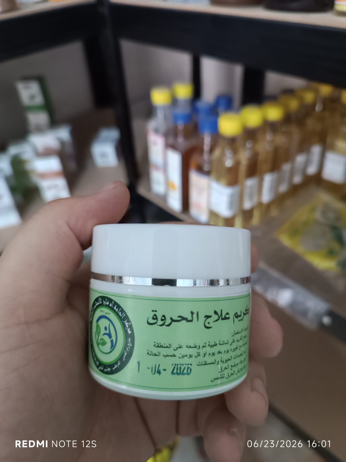 كريم علاج الحروق